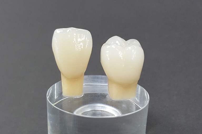 歯科医療で使われる金属素材について